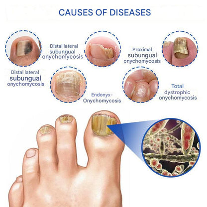 ClearZap™ Zařízení pro světelnou terapii plísní | Rychlé, účinné a bezbolestné řešení!