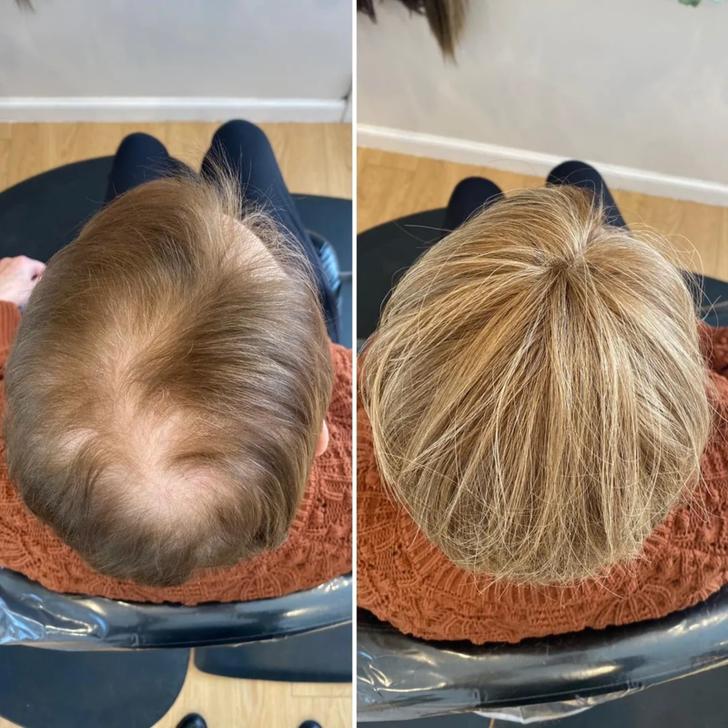 CrownLift™️ Jemný příčesek do vlasů | Husté vlasy běhen sekundy!