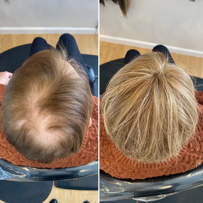 CrownLift™️ Jemný příčesek do vlasů | Husté vlasy běhen sekundy!