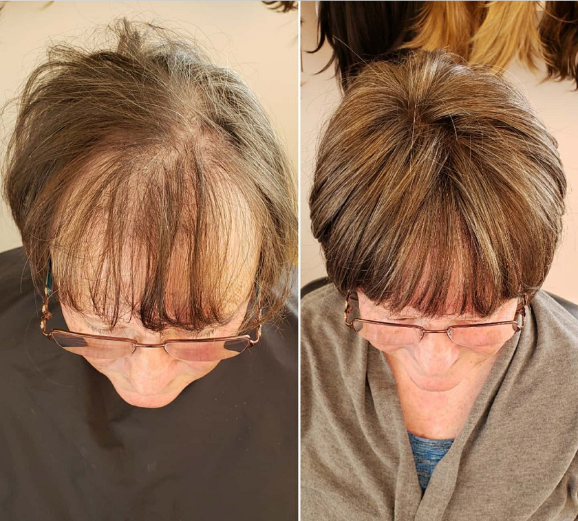 CrownLift™️ Jemný příčesek do vlasů | Husté vlasy běhen sekundy!