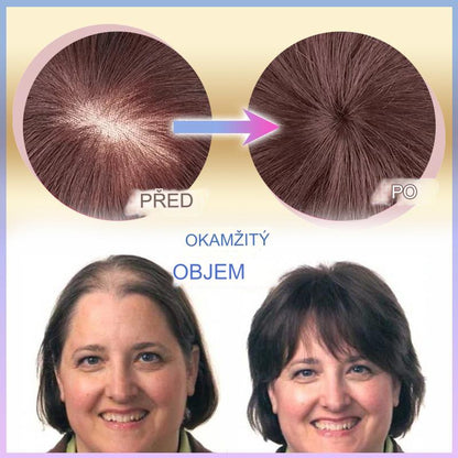CrownLift™️ Jemný příčesek do vlasů | Husté vlasy běhen sekundy!
