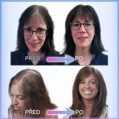 CrownLift™️ Jemný příčesek do vlasů | Husté vlasy běhen sekundy!