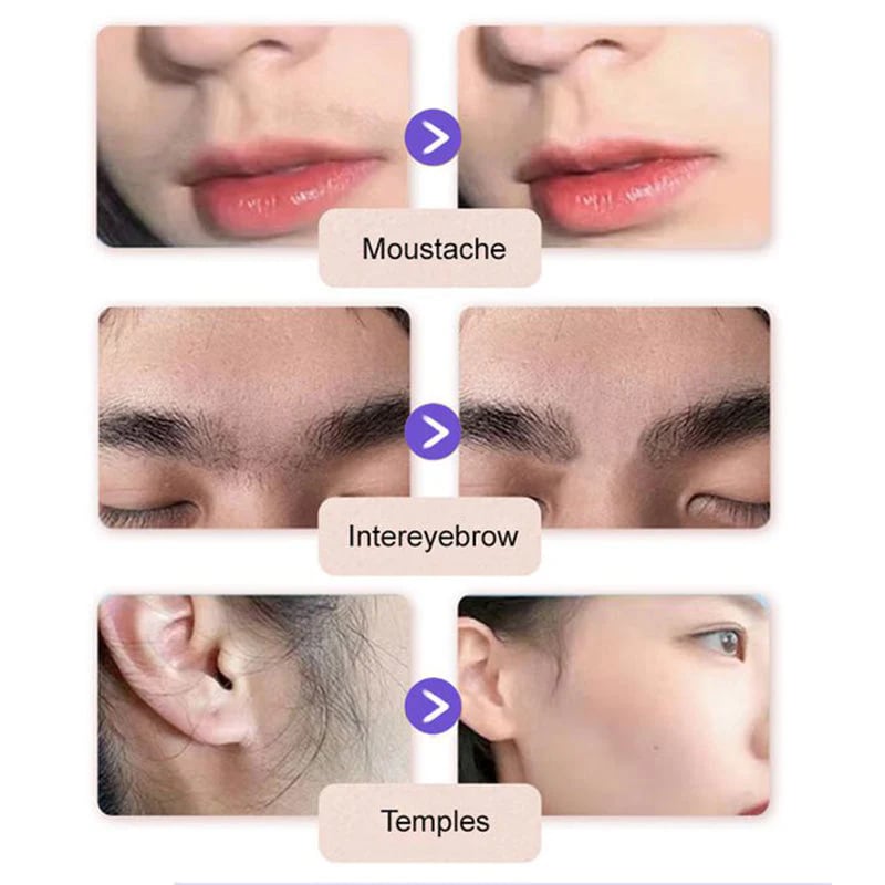 Dermade™ Jemný a bezbolestný krém na odstranění chloupků v obličeji