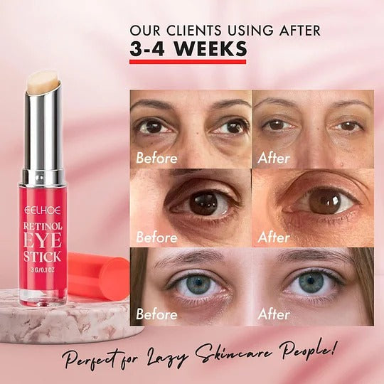 EELHOE Stick™ Retinolový oční krém v tyčince