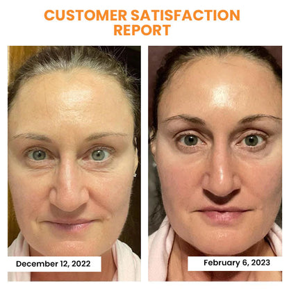 EELHOE™ Kosmetika proti vráskám 2v1