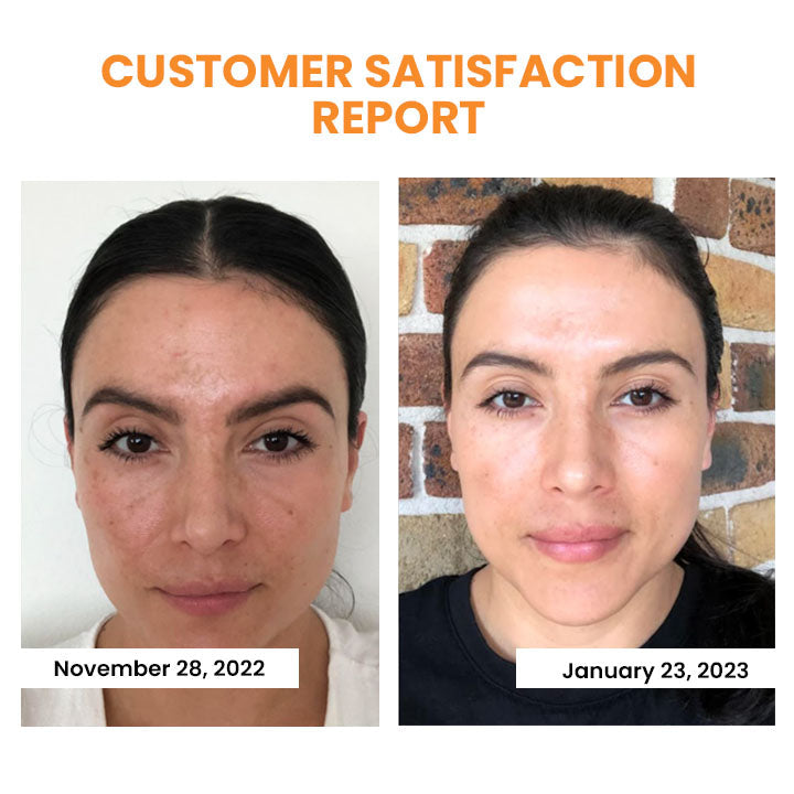 EELHOE™ Kosmetika proti vráskám 2v1