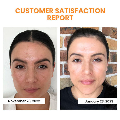 EELHOE™ Kosmetika proti vráskám 2v1