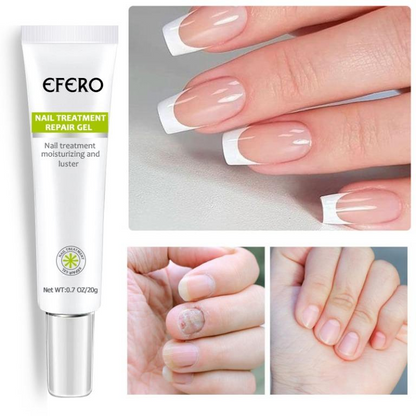 Efero MyCare™ Gel pro ošetření nehtů