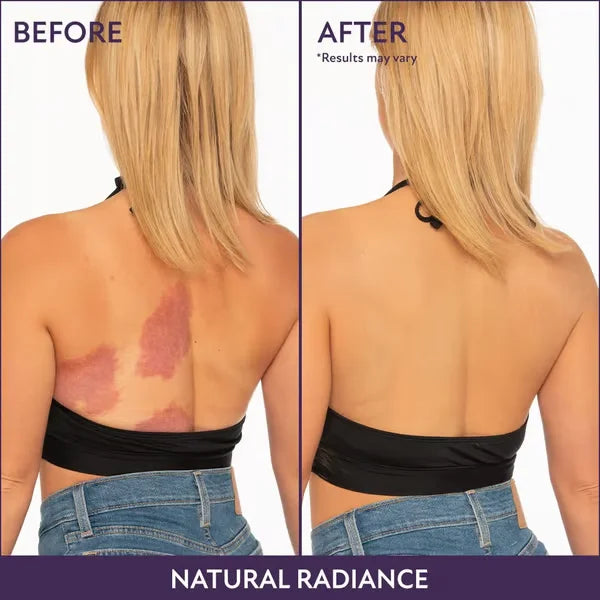 HydraTint™ Hydratační korektor