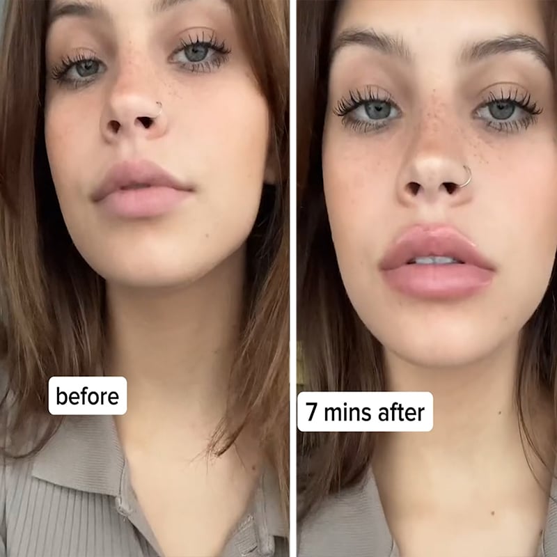 KissBeauty™ Okamžitá výplň rtů plumper