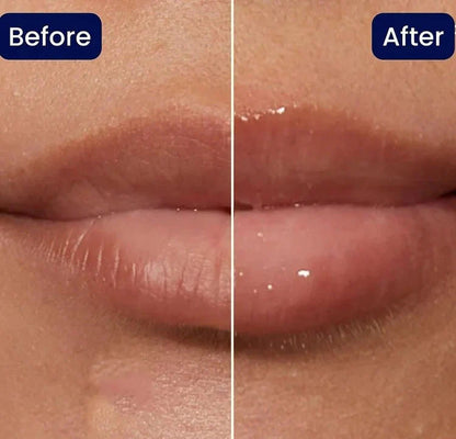 KissBeauty™ Okamžitá výplň rtů plumper