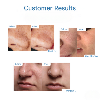 RevivaSkin™ Sérum pro obnovu pleti