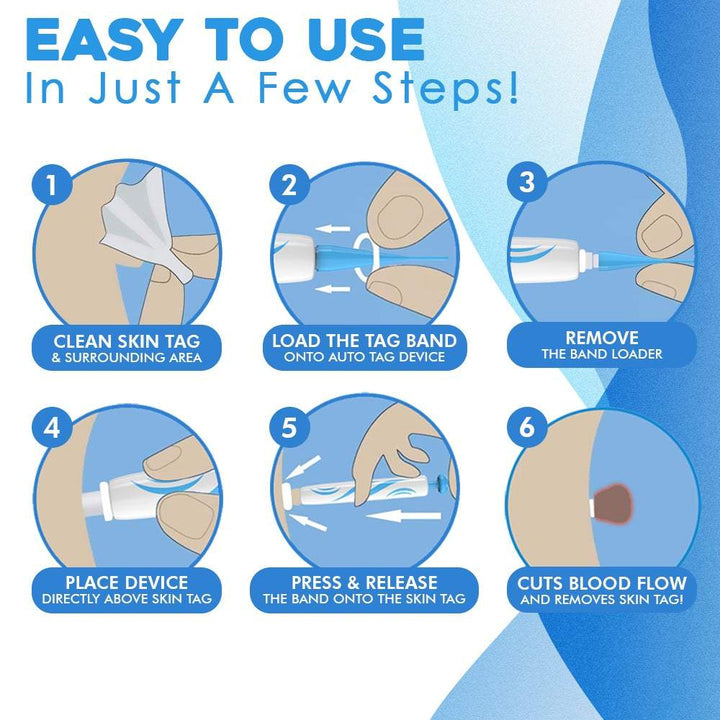 TagAway™ Sada pro pokročilé odstraňování kožních výrostků