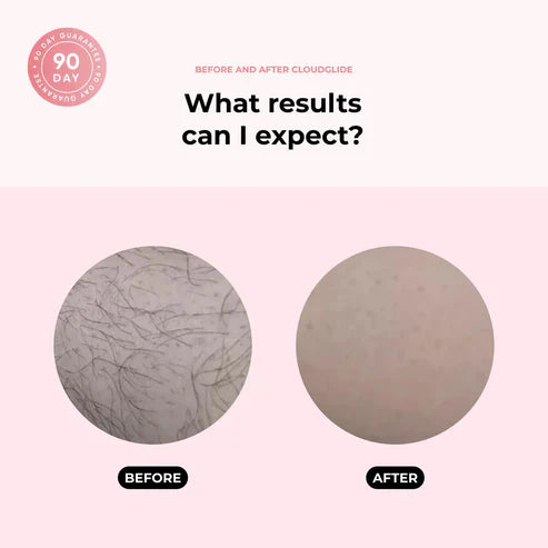 TrimTech™ Holicí strojek pro hedvábnou kůži