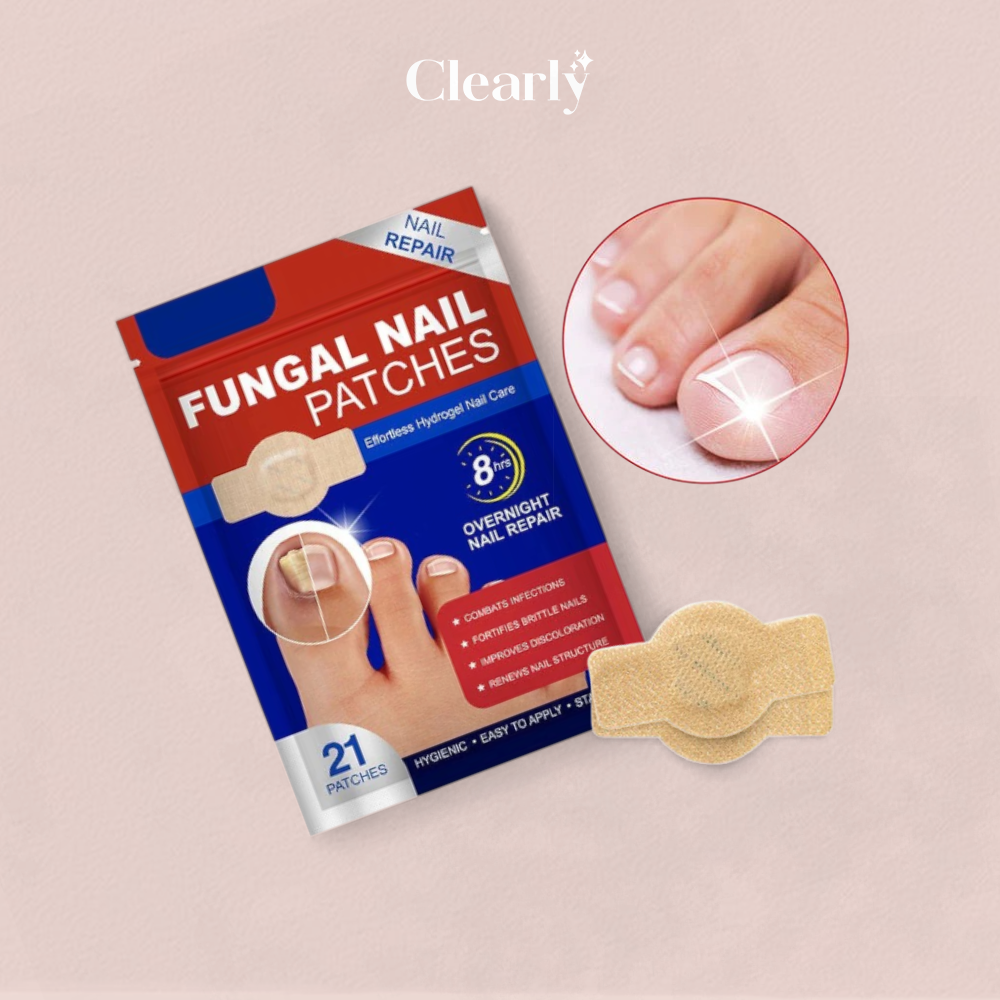 NailNex™ účinná léčba plísně nehtů