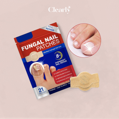 NailNex™ účinná léčba plísně nehtů